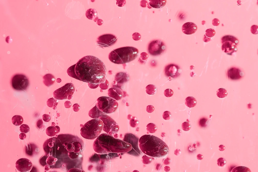 DISLIPIDEMIA NA SÍNDROME DE DOWN (T21) - Nutri Consulta