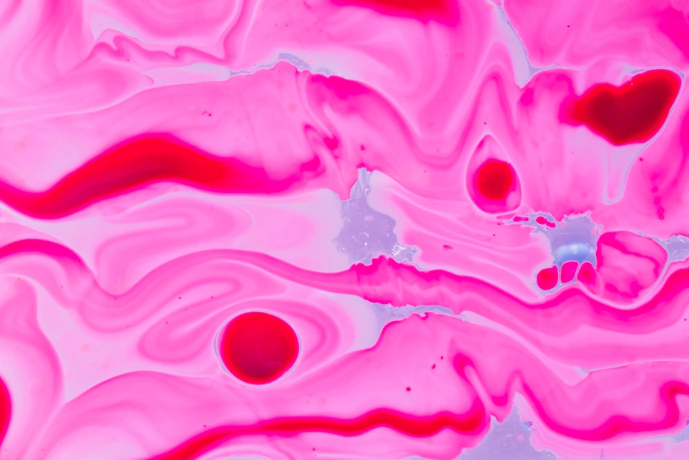 Esteatose hepática: como o acompanhamento nutricional pode ajudar Esteatose hepática: como o acompanhamento nutricional pode ajudar